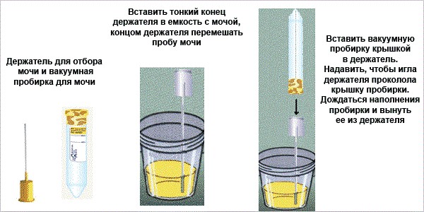 Как правильно сделать анализ мочи на посев