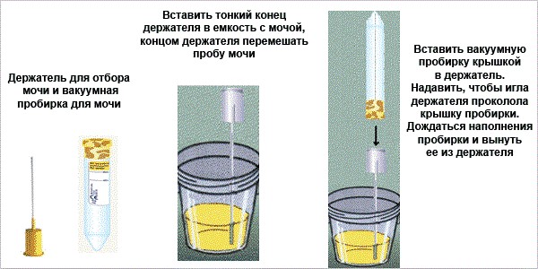 Схема сбора мочи